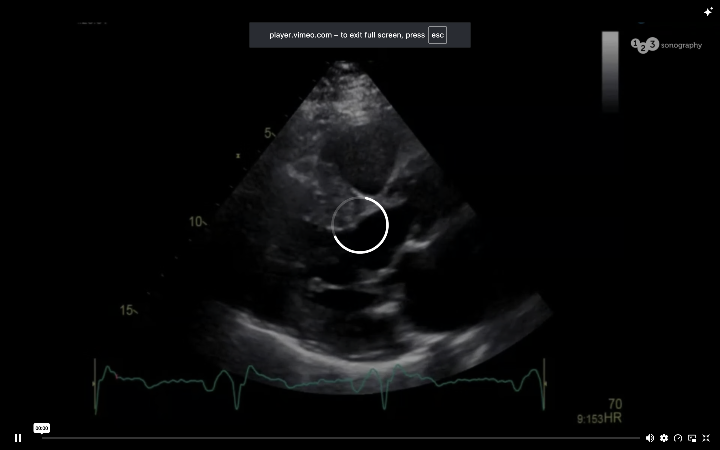 60 Seconds Case – What surgery was performed?